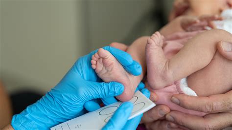 Foto de una prueba de cribado neonatal (pinchazo en el talón del bebé).