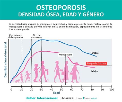 Gráfico comparativo de densidad ósea a lo largo de la vida