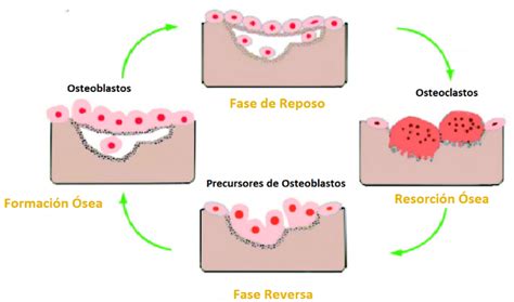 Esquema del proceso de remodelación ósea (activación, reabsorción, formación)