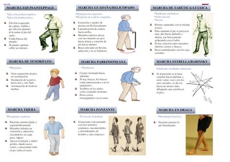 Infografía: Tipos de marchas anormales y sus características