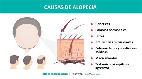 diagrama de las principales causas de alopecia en la vejez