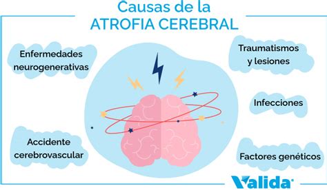 Infografía: Mapa de atrofia cerebral y áreas afectadas