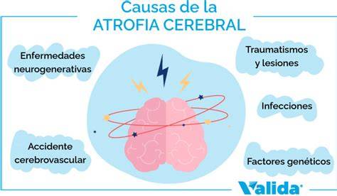 Mapa de posibles áreas afectadas por la atrofia cerebral y su impacto funcional