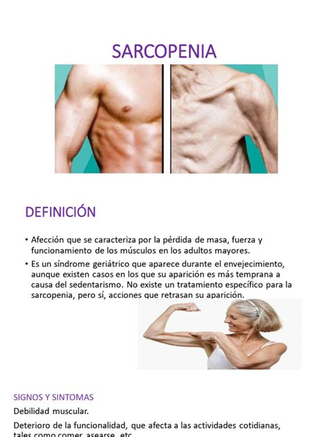 Gráfico de prevalencia de sarcopenia por edad y género