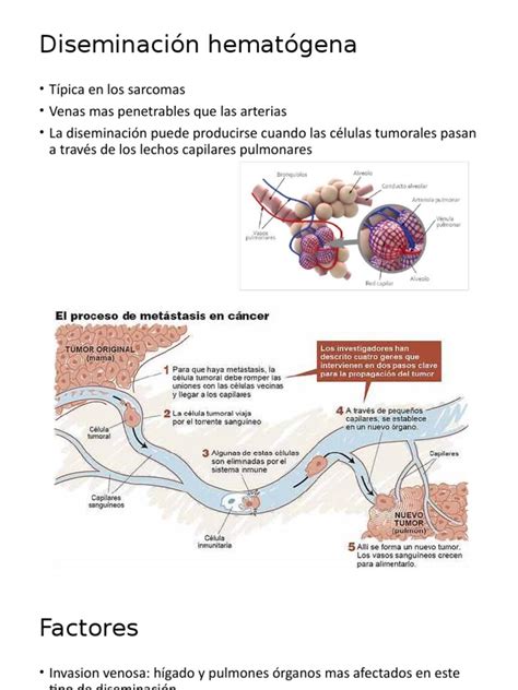 Diagrama que ilustra la diseminación hematógena de S. aureus desde un foco infeccioso en la piel a la aorta.