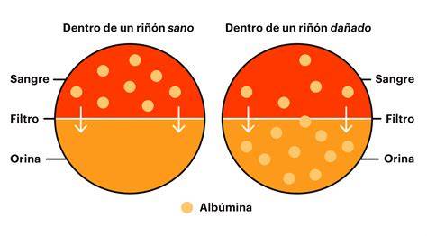 Gráfico ROC del cociente PCR/albúmina para la predicción de la gravedad de la colitis ulcerosa