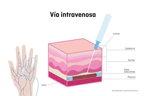Diagrama mostrando las diferentes vías de administración de la betametasona: oral, intramuscular, intravenosa y tópica.
