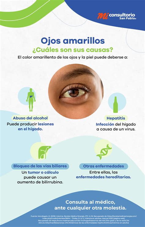 Ilustración conceptual de seres intraterrestres con ojos amarillos y peludos