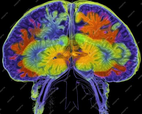 Escáner de actividad cerebral comparando a jóvenes y adultos mayores con alto y bajo rendimiento