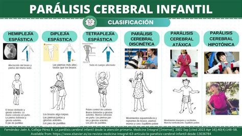 Infografía: Tipos y prevalencia de parálisis cerebral infantil