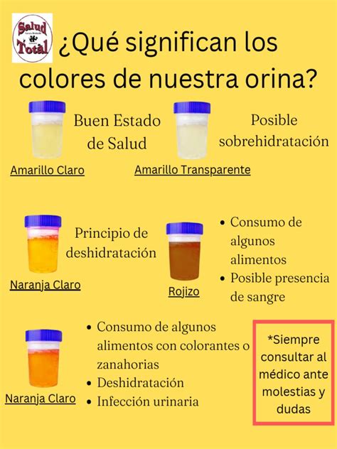 Tabla o infografía de colores de orina y su significado