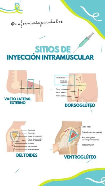 Diagrama de sitios de inyección intramuscular segura (glúteo, deltoides, vasto lateral)