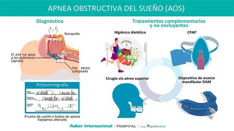 Infografía explicativa sobre la apnea obstructiva del sueño y su tratamiento con CPAP
