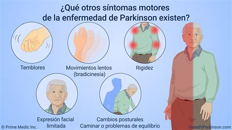 Tabla con los principales síntomas motores y no motores del Parkinson