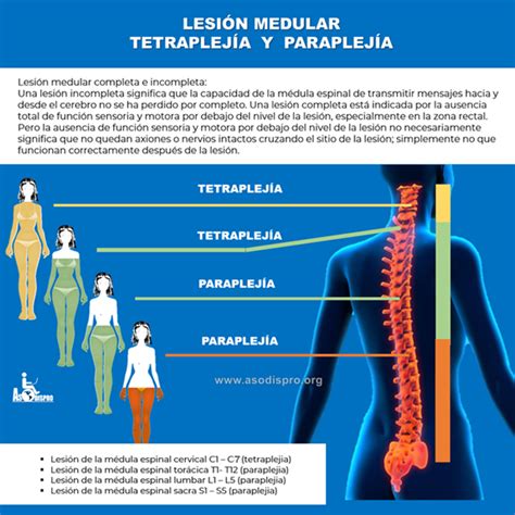 Gráfico de diferencias entre paraplejia y tetraplejia por áreas afectadas
