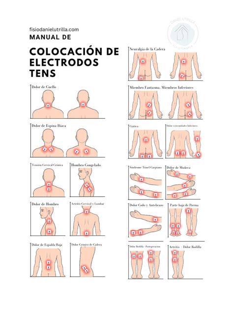 Diagrama mostrando la colocación de electrodos TENS en diferentes áreas del cuerpo para el alivio del dolor