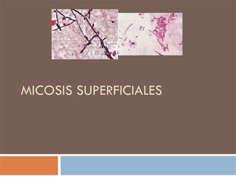 Mapa de distribución de micosis superficiales en adultos mayores en Venezuela