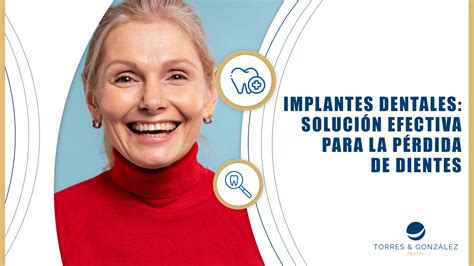 Ilustración: Implantes dentales como solución para la pérdida de dientes