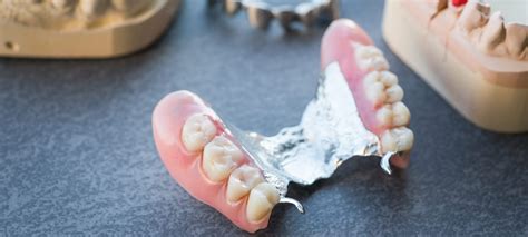 Diagrama comparativo: Dentadura postiza vs. Implantes dentales