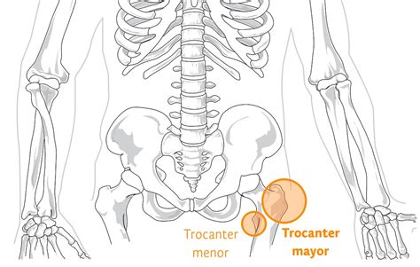 Esquema anatómico mostrando el trocánter mayor y la ubicación estratégica de las almohadillas protectoras de cadera para absorber impactos.