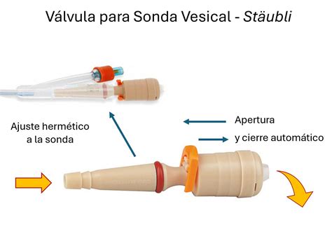 Fotografía de la válvula urinaria Stäubli conectada a un catéter de cistostomía