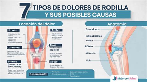 Gráfico mostrando las causas más comunes de dolor de rodilla en adultos mayores con porcentajes