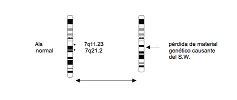 Infografía: cromosoma 7q11.23 - deleción y genes implicados