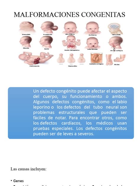 Infografía comparativa de las diferentes malformaciones congénitas de la mano