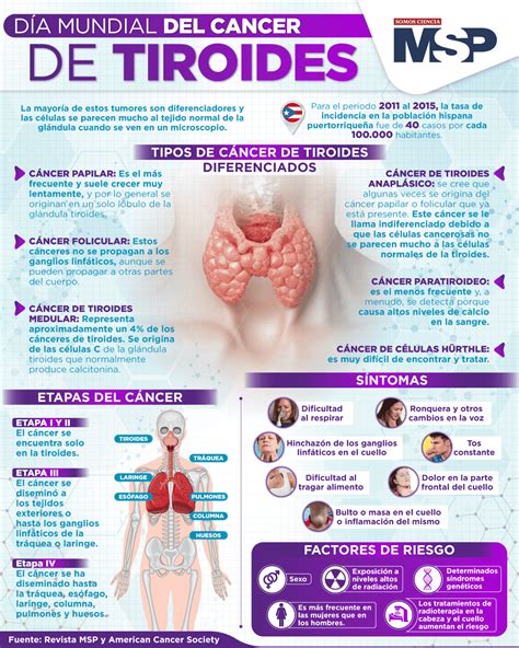 Infografía comparativa de los tratamientos para los diferentes tipos de cáncer de tiroides.