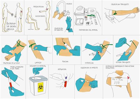 Esquema del procedimiento de extracción de sangre para análisis de AFP en el brazo de una mujer embarazada.