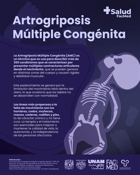 Infografía o esquema sobre la artrogriposis múltiple congénita