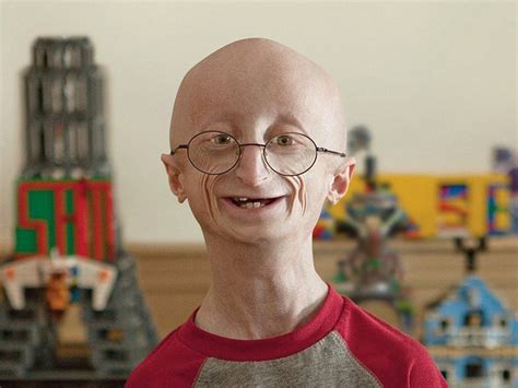 Foto de Sam Berns, sonriendo y con el aspecto característico de la progeria