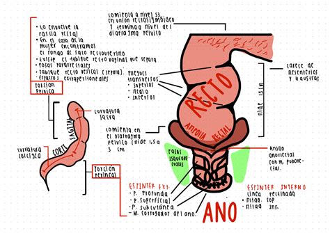 Esquema anatómico del ano y recto con una fisura anal