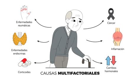 Esquema visual que ilustra la progresión de la sarcopenia y sus efectos en el cuerpo de un adulto mayor