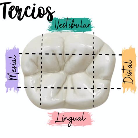 diagrama de un diente con un sellante dental aplicado en las superficies de masticación