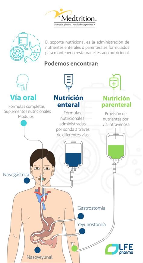 Diagrama de las diferentes vías de acceso para nutrición enteral