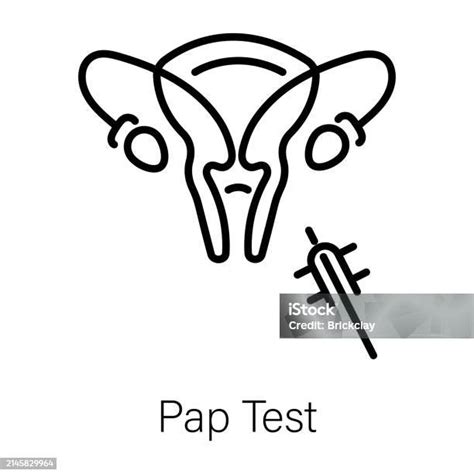 Ilustración de una prueba de Papanicolaou