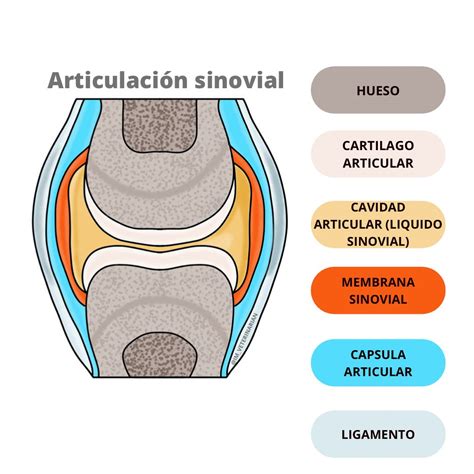 Esquema general de una articulación sinovial con sus componentes principales: huesos, cartílago articular, membrana sinovial y líquido sinovial