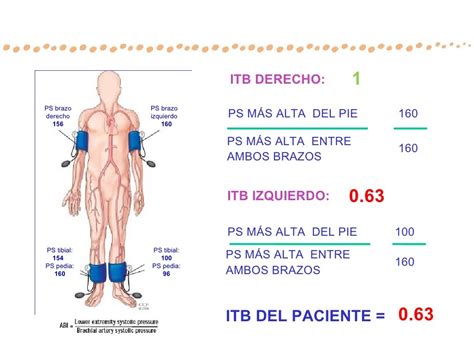 Diagrama que ilustra cómo se realiza la prueba del índice tobillo-brazo (ITB) para diagnosticar arteriopatía periférica.