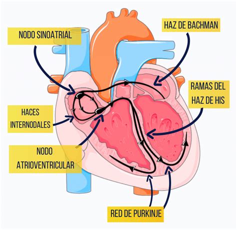 Esquema del sistema de conducción eléctrica del corazón mostrando un latido normal y uno irregular (arritmia)