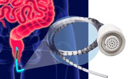 Imagen de equipo de manometría anorrectal