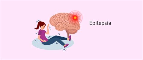 Diagrama: Tipos de epilepsias y sus patrones de afectación cognitiva característicos, incluyendo la afectación cognitiva a largo plazo