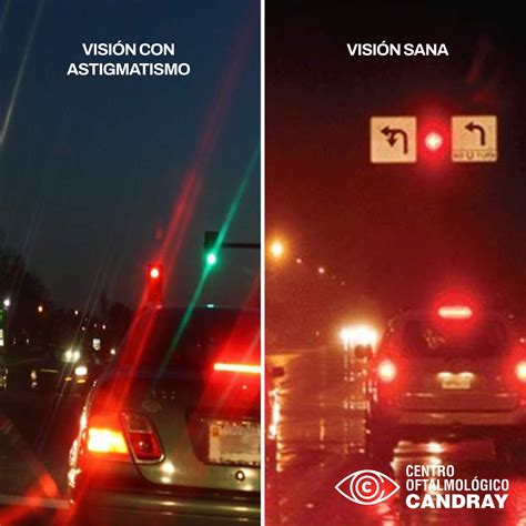 Representación visual de cómo las luces de un semáforo se ven con astigmatismo (con halos y destellos) versus visión normal