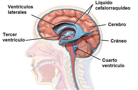 Diagrama mostrando la acumulación de líquido cefalorraquídeo en el cerebro
