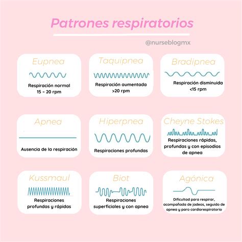 Esquema de un patrón respiratorio de Cheyne-Stokes mostrando ciclos de aumento y disminución de la amplitud de la respiración seguidos de apneas.