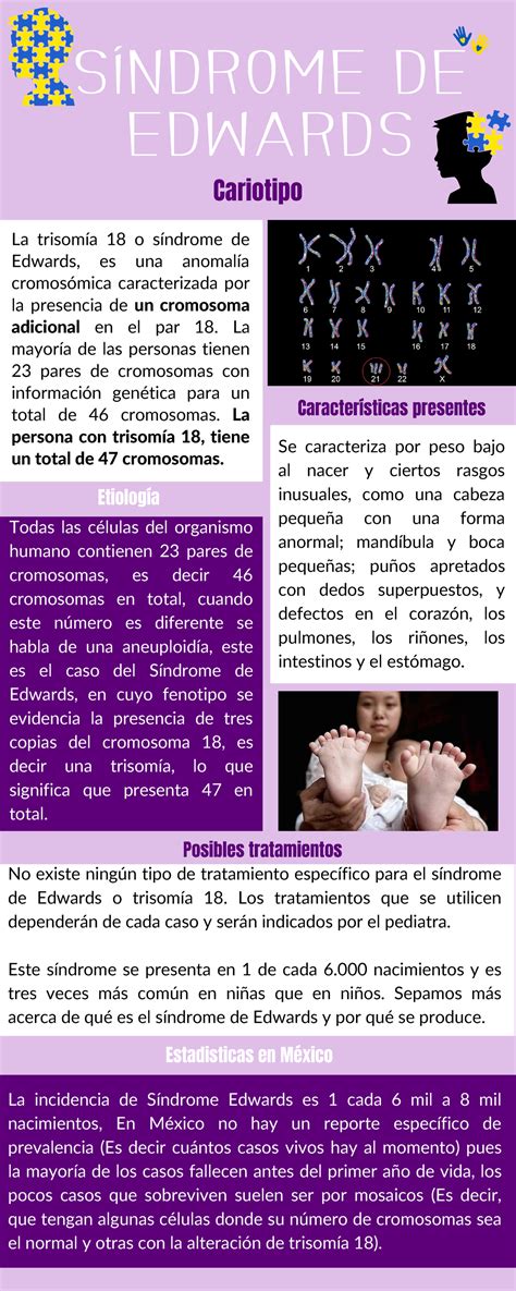 Esquema o infografía de las principales malformaciones en el síndrome de Edwards