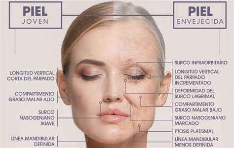 Diagrama comparativo de piel joven y piel envejecida
