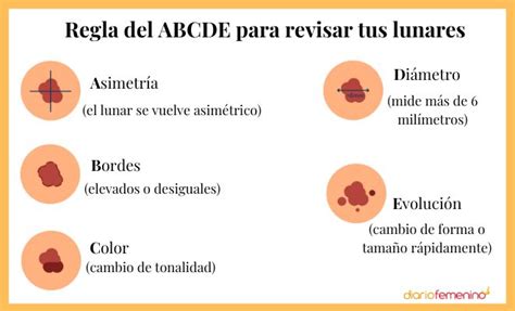 Infografía: Guía para autoexploración de manchas en la piel (regla ABCD)