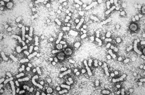 Micrografía de virus de la hepatitis B en tejido hepático