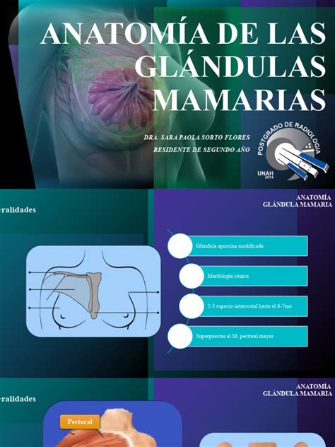 Infografía mostrando la ubicación de las glándulas mamarias en una perra y las zonas más comunes de aparición de tumores.